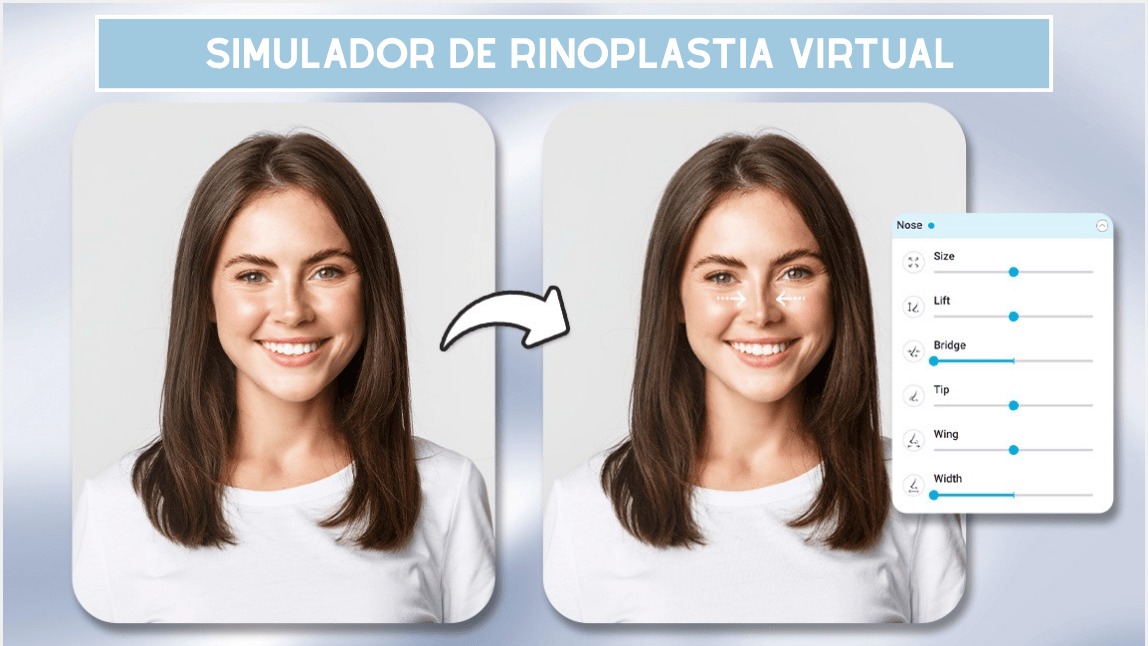 Simulador de rinoplastia virtual gratis.