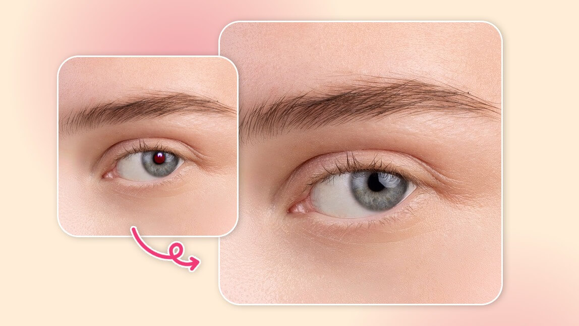 Best Red Eye Remover: How to Get Rid of Red Eye in Photos [iPhone & Android]