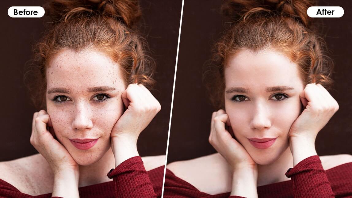 How to Get Rid of Dark Spots on Your Face & Body