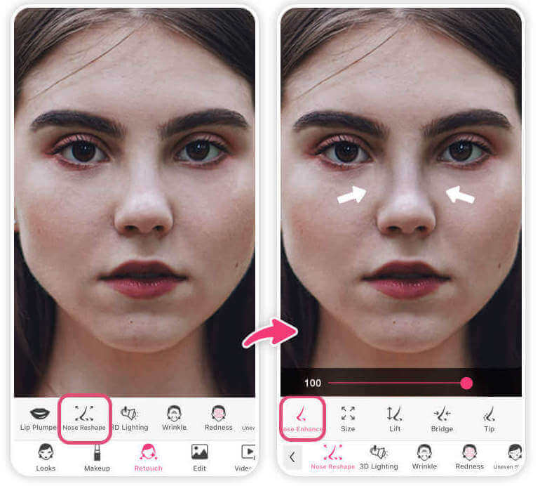 Meilleure appli pour affiner son nez via simulation rhinoplastie