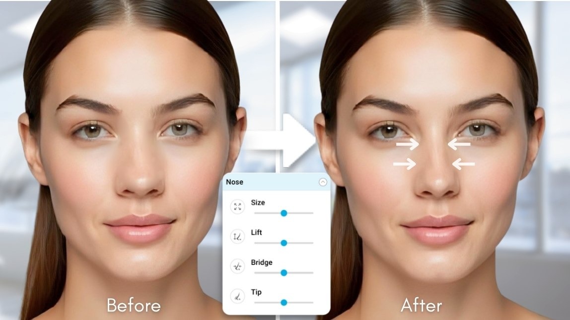 AI Nose Type Detection for Aesthetic Clinics