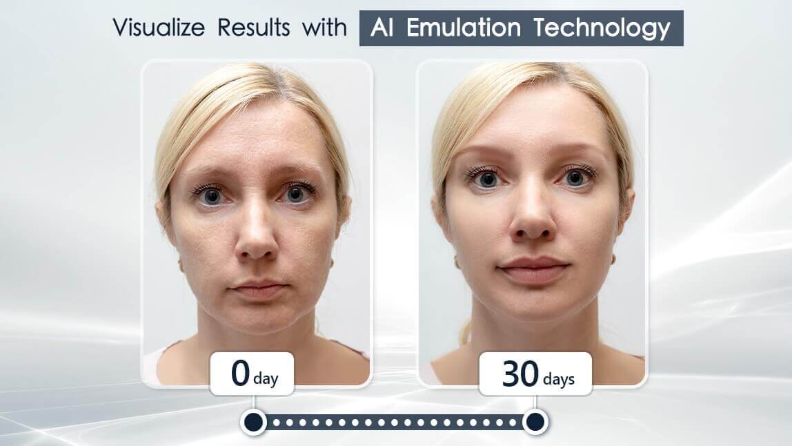 ai skin simulation
