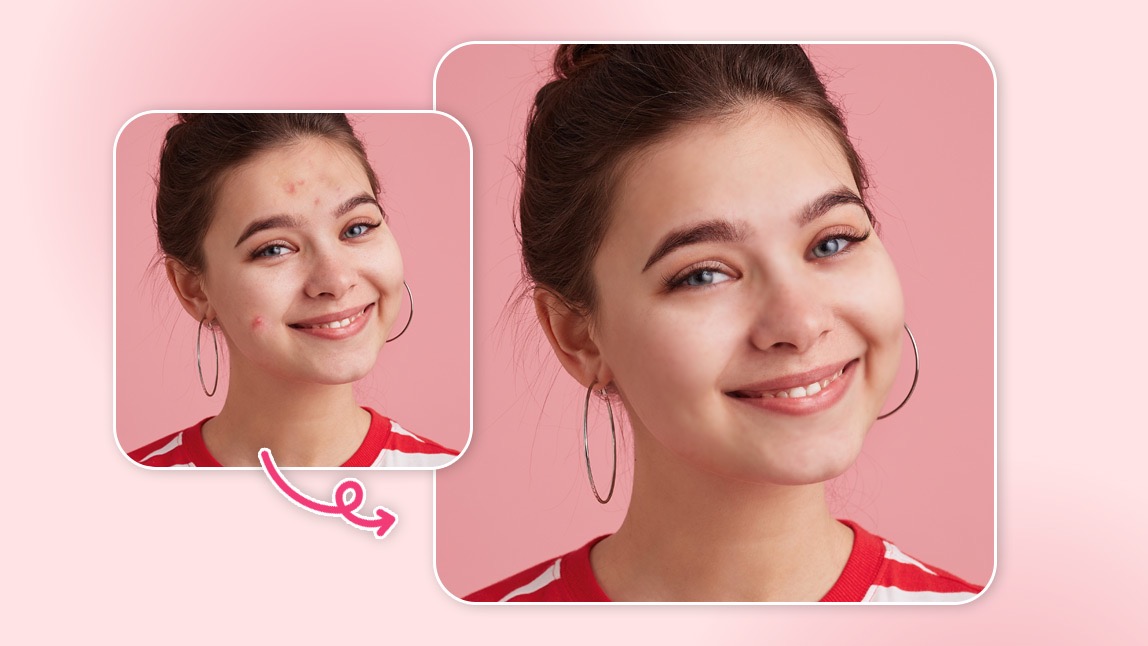 How to Remove Pimples From Photos on iPhone & Android