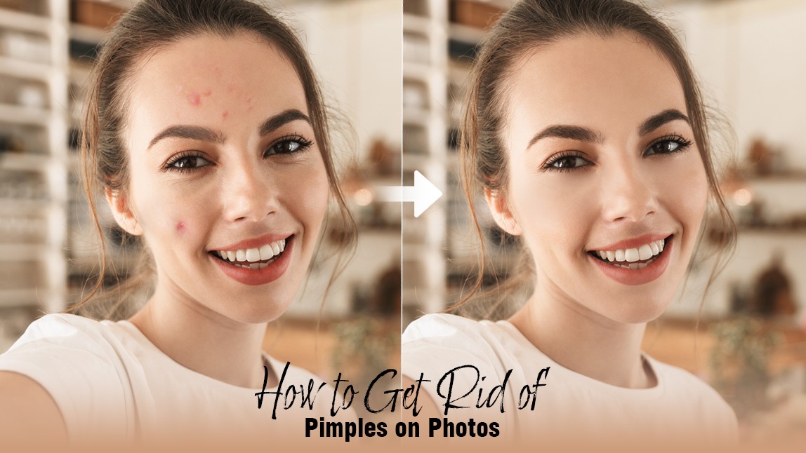 How to Get Rid of Pimples in 5 Minutes: 6 Useful Tips & AI Photo Fix
