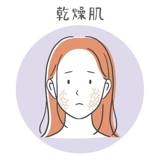 乾燥肌 乾燥肌
