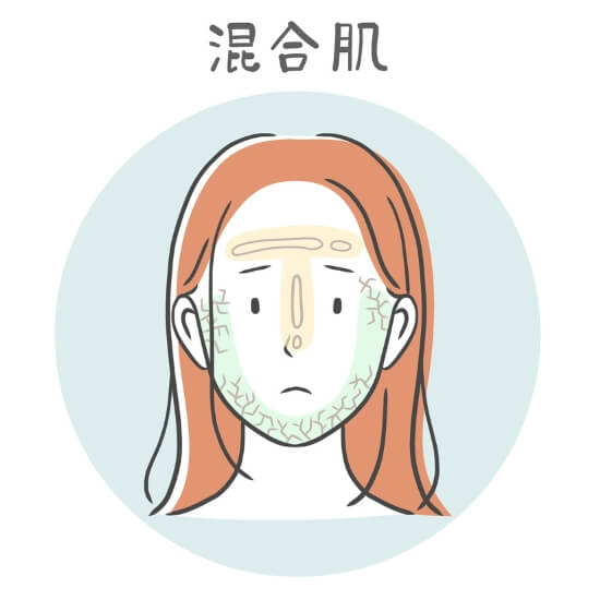 混合肌 混合肌