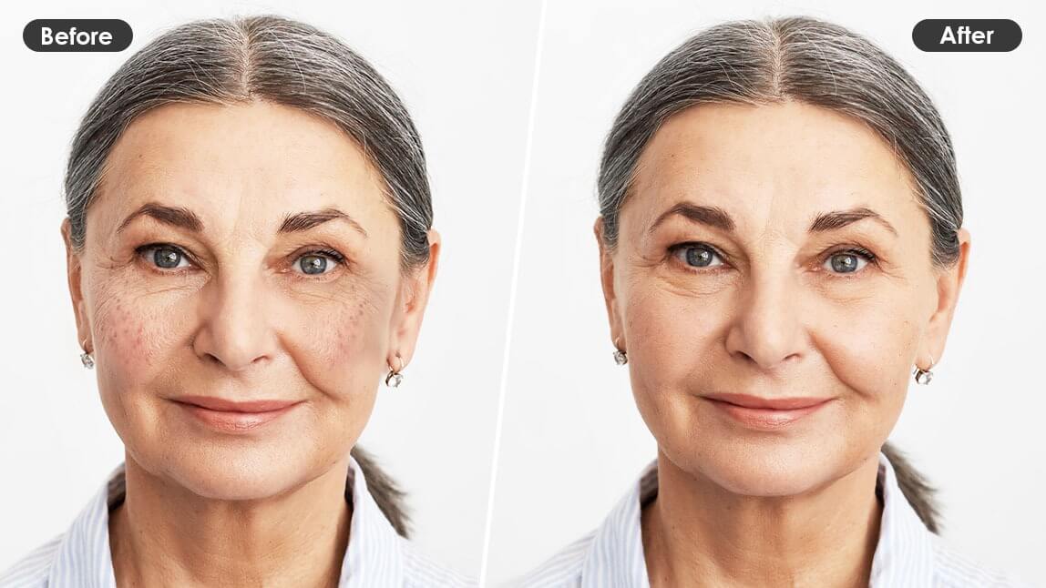 Antes e depois de mulher idosa removendo manchas senis e de idade do rosto com aplicativo de edição YouCam Makeup.