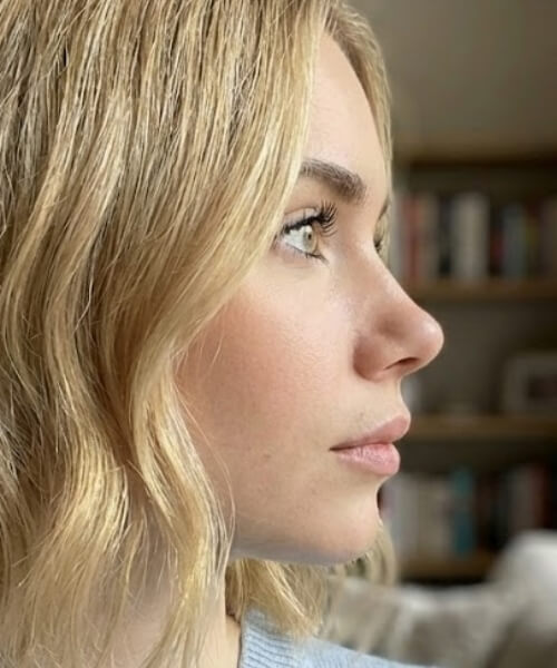 Concave Nose Concave Nose