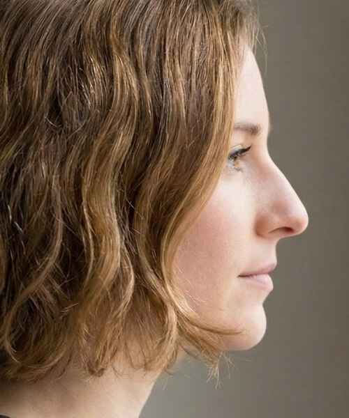 Straight Nose Straight Nose