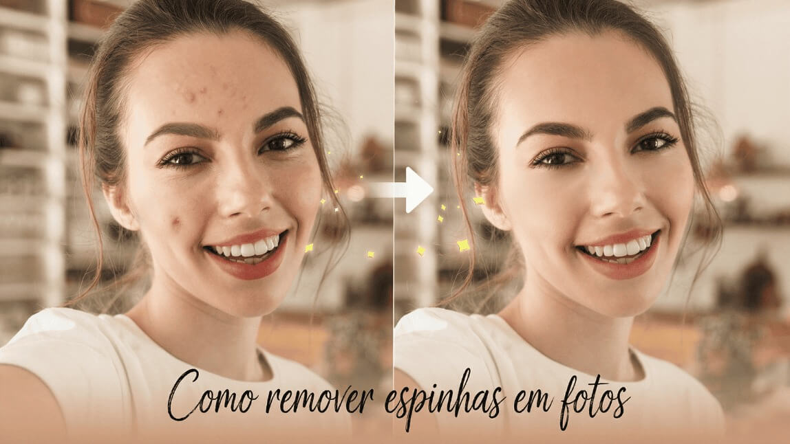 Antes e depois de mulher sorrindo com espinhas removidas do rosto usando aplicativo de edição de fotos.