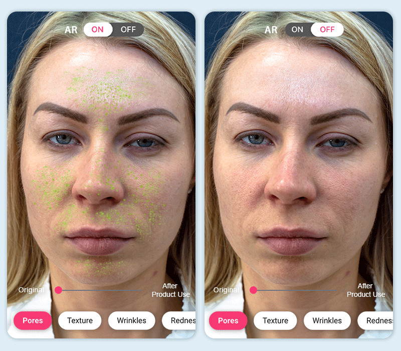 skin pores analysis app skin pores analysis app
