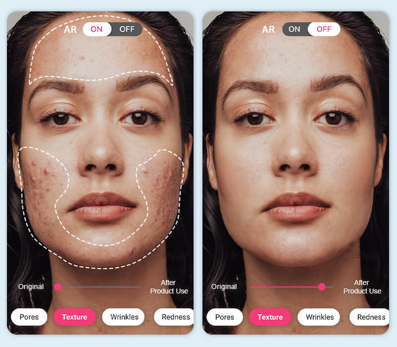 skin texture analysis skin texture analysis