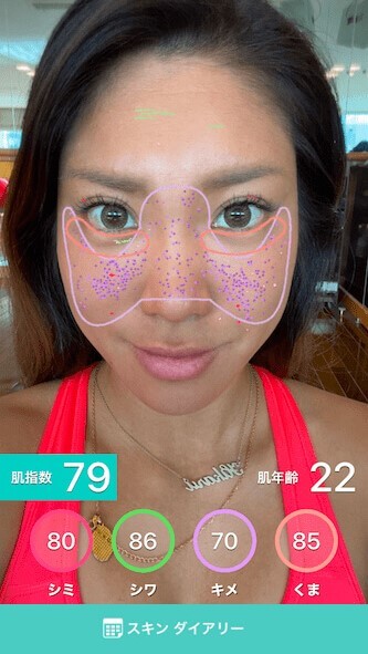 肌診断する様子