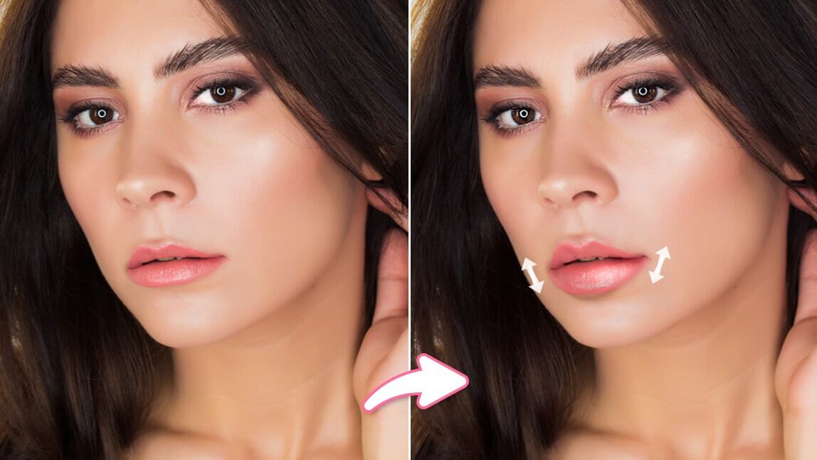 Lip Filler Filter: What Would I Look Like with Lip Filler