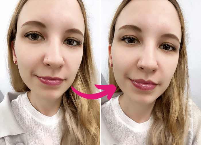 see how you would look with lip fillers