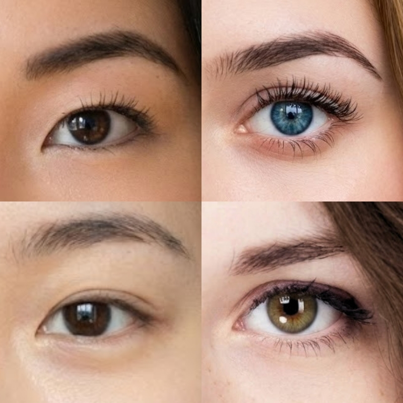 4 types of eyelids