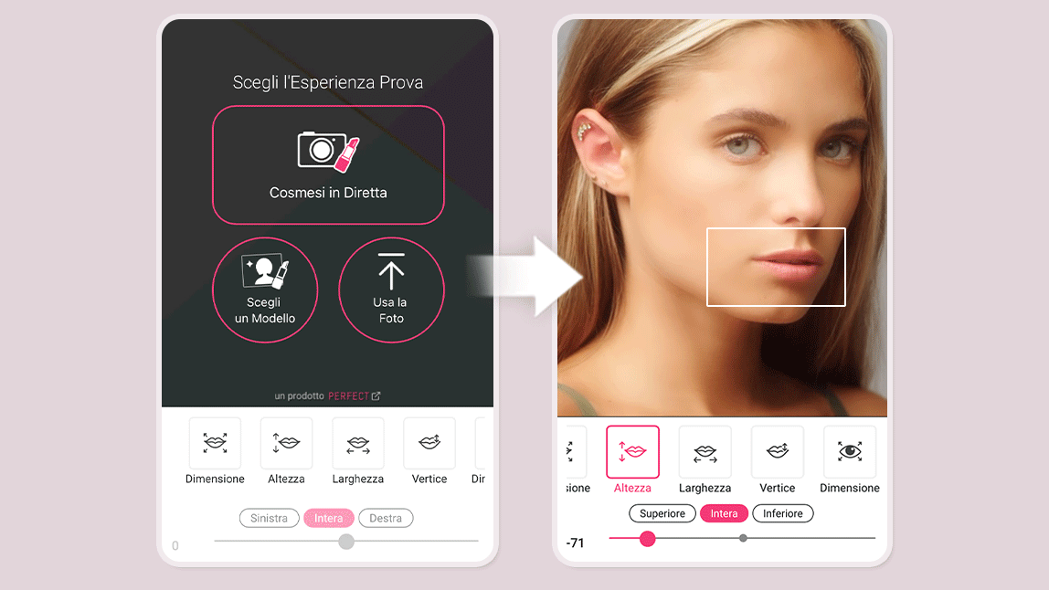 Labbra Con Filler Prima e Dopo: Risultati Personalizzabili