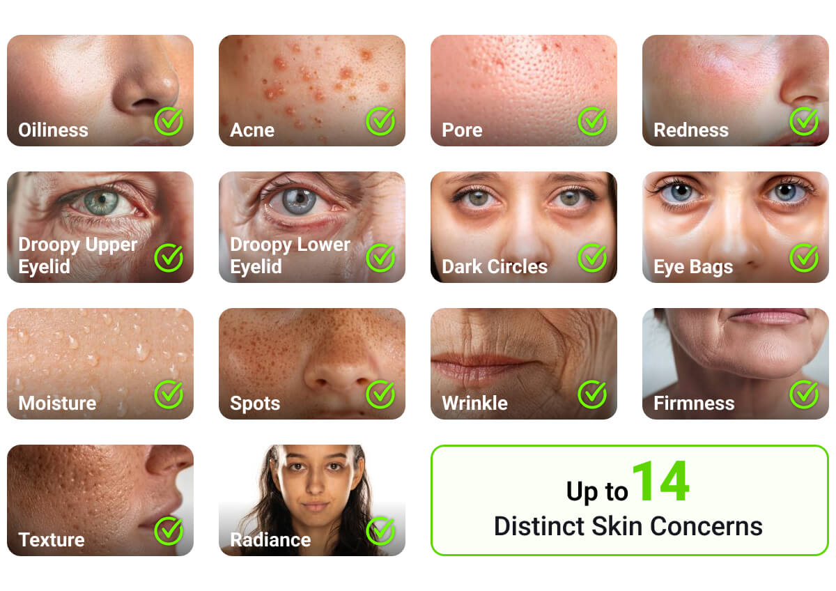 skin analysis skin concerns skin analysis skin concerns