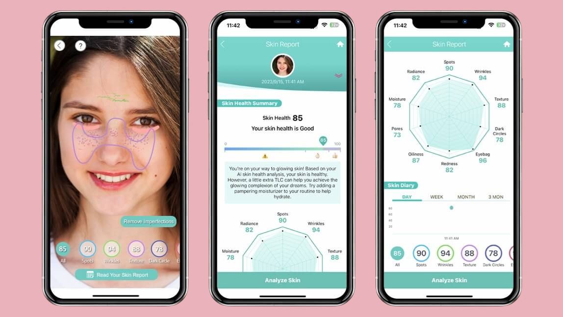 skin analysis tracking skin analysis tracking