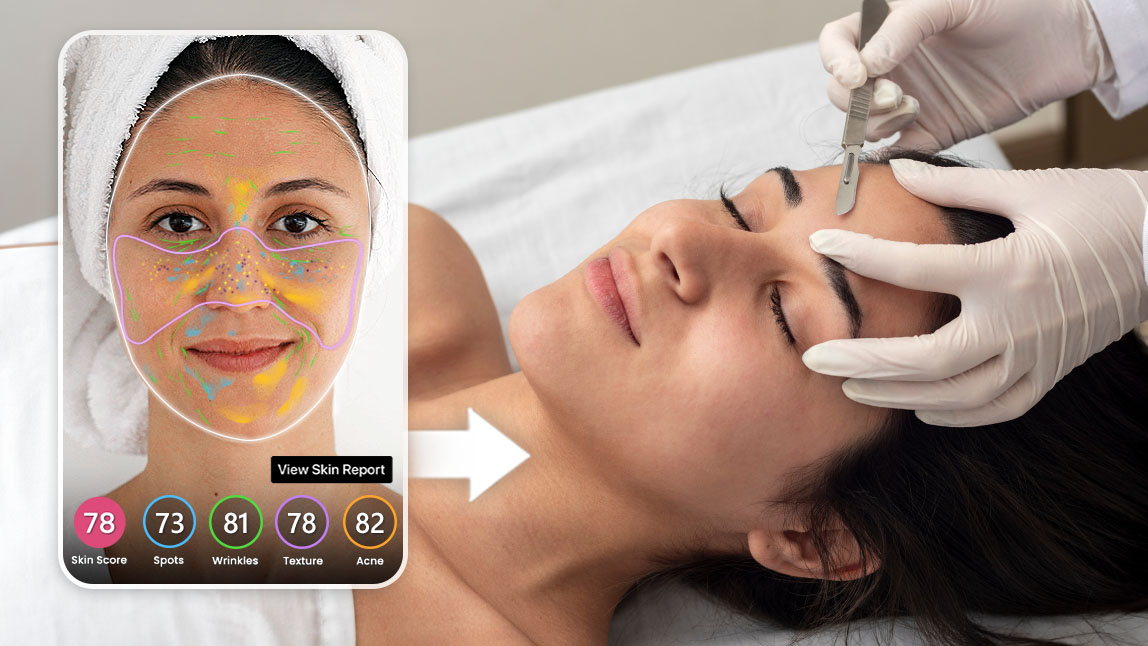 skin analysis skin analysis