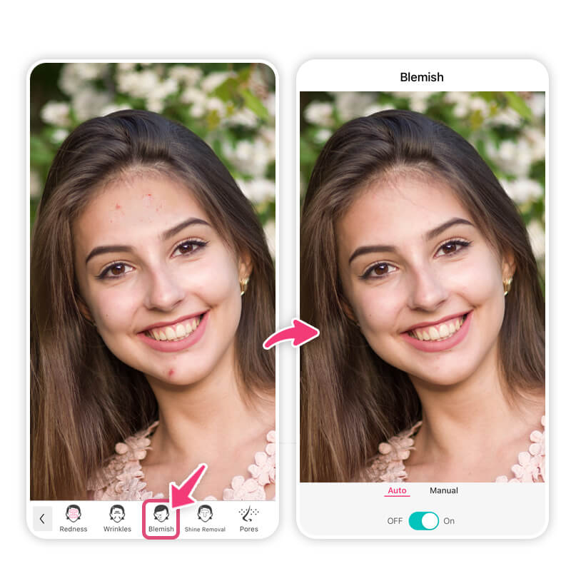 Blemish, the app detects imperfections and removes them automatically Blemish, the app detects imperfections and removes them automatically