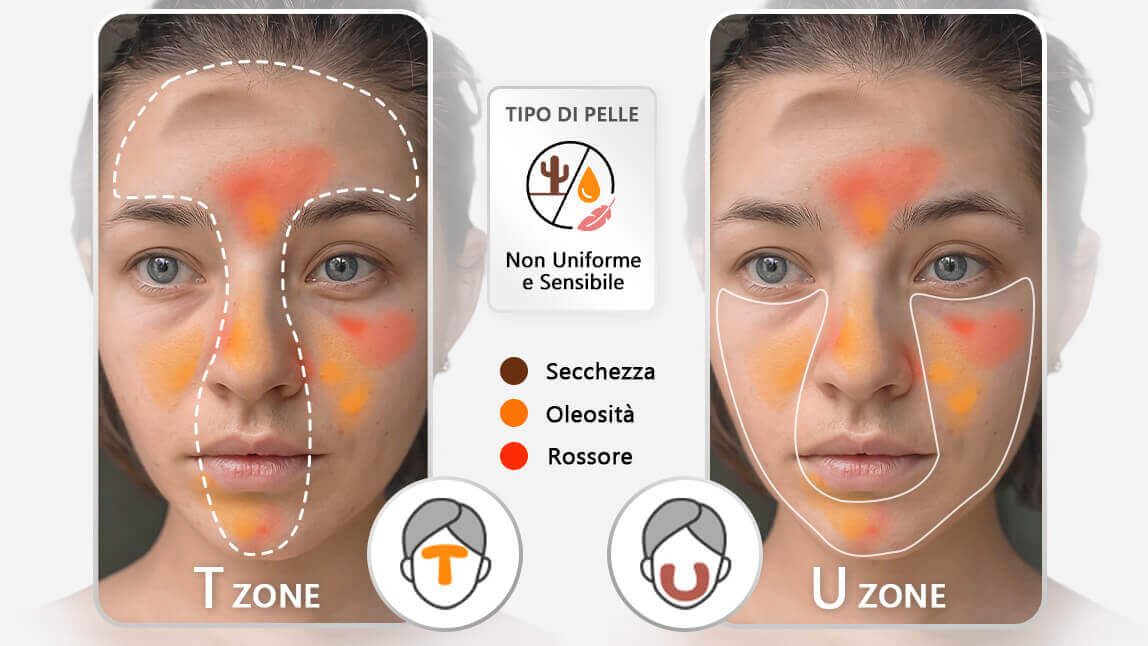 Skin Analyzer AI: Capacità Avanzate nell'Identificazione del Tipo di Pelle