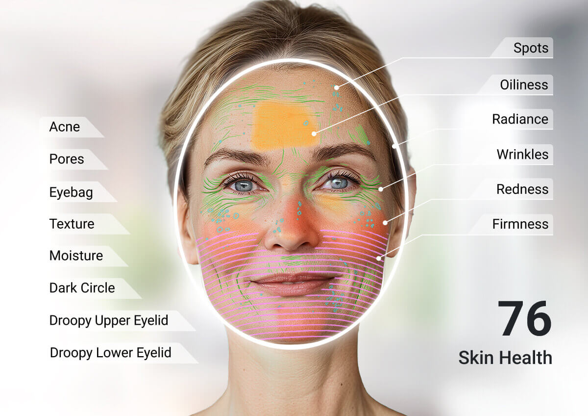 skin analysis detection skin analysis detection
