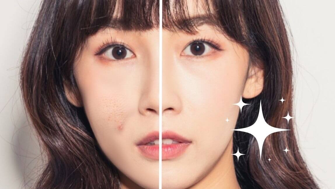 사진 보정하는 어플 추천 5! 사진에서 잡티 여드름 가장 쉽게 제거하는 앱