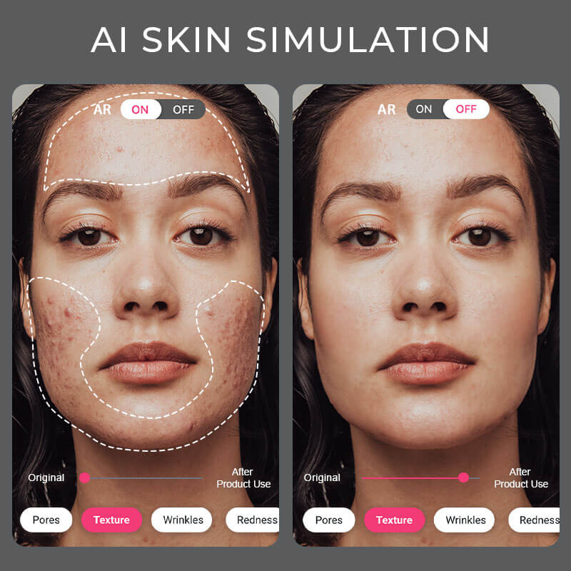 ai skin simulation