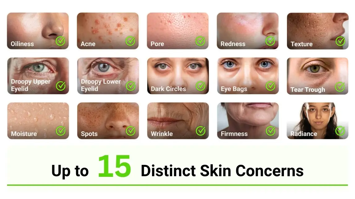 skin analysis skin analysis
