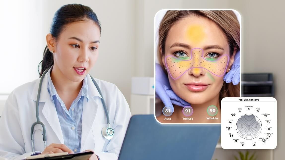 skin analysis tool for clinics