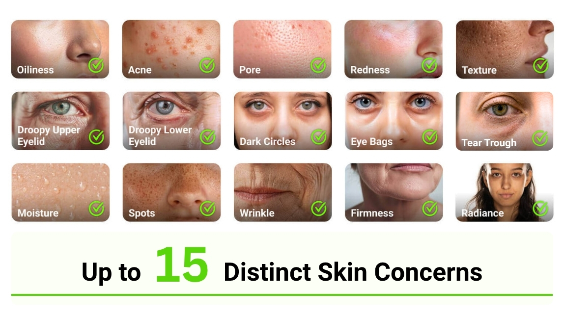 skin concerns detection