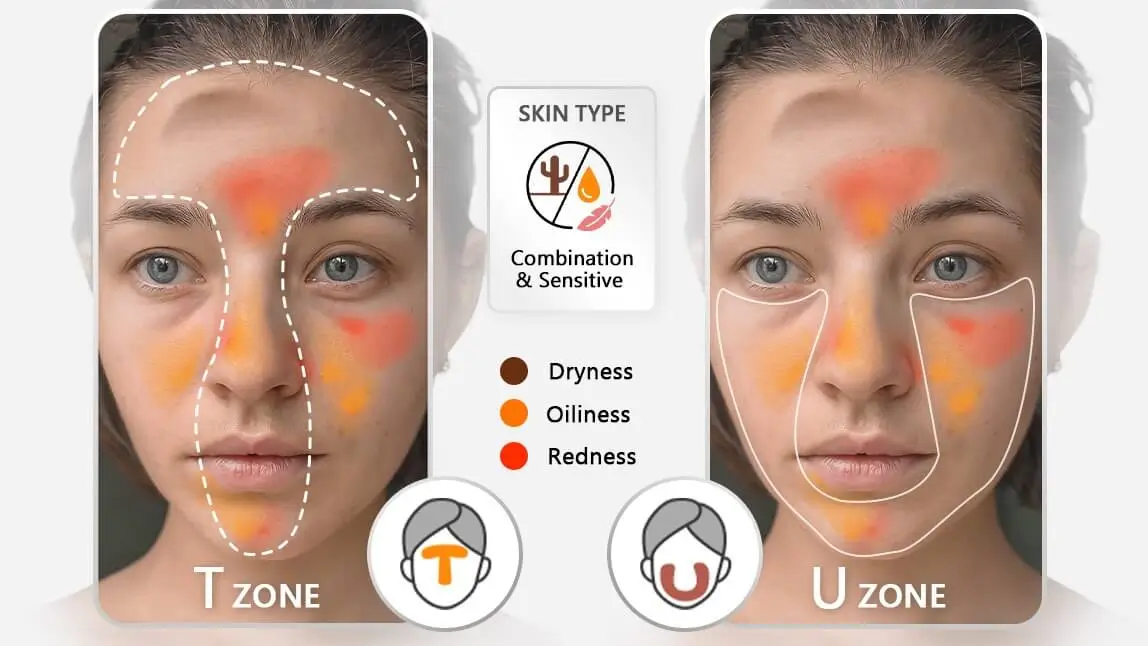 8 skin types detection 8 skin types detection