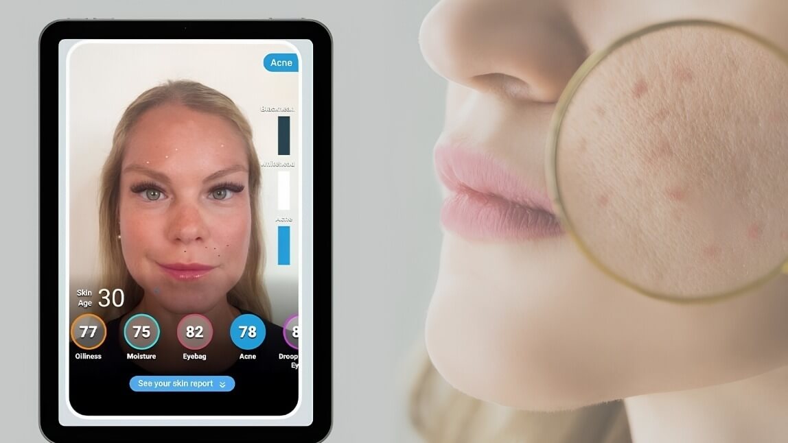 Skin Analysis Website