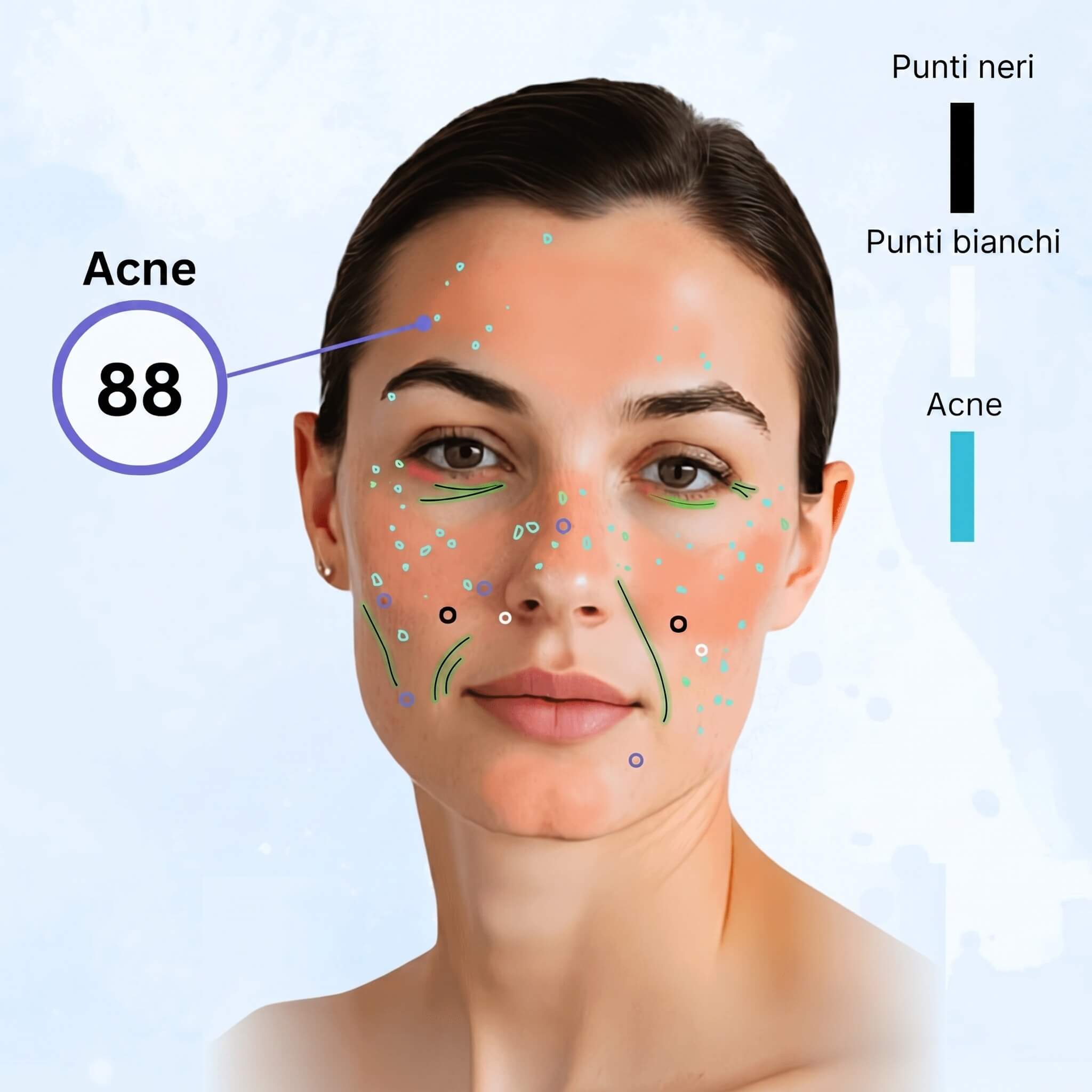 Rilevamento dell’acne sul viso Rilevamento dell’acne sul viso