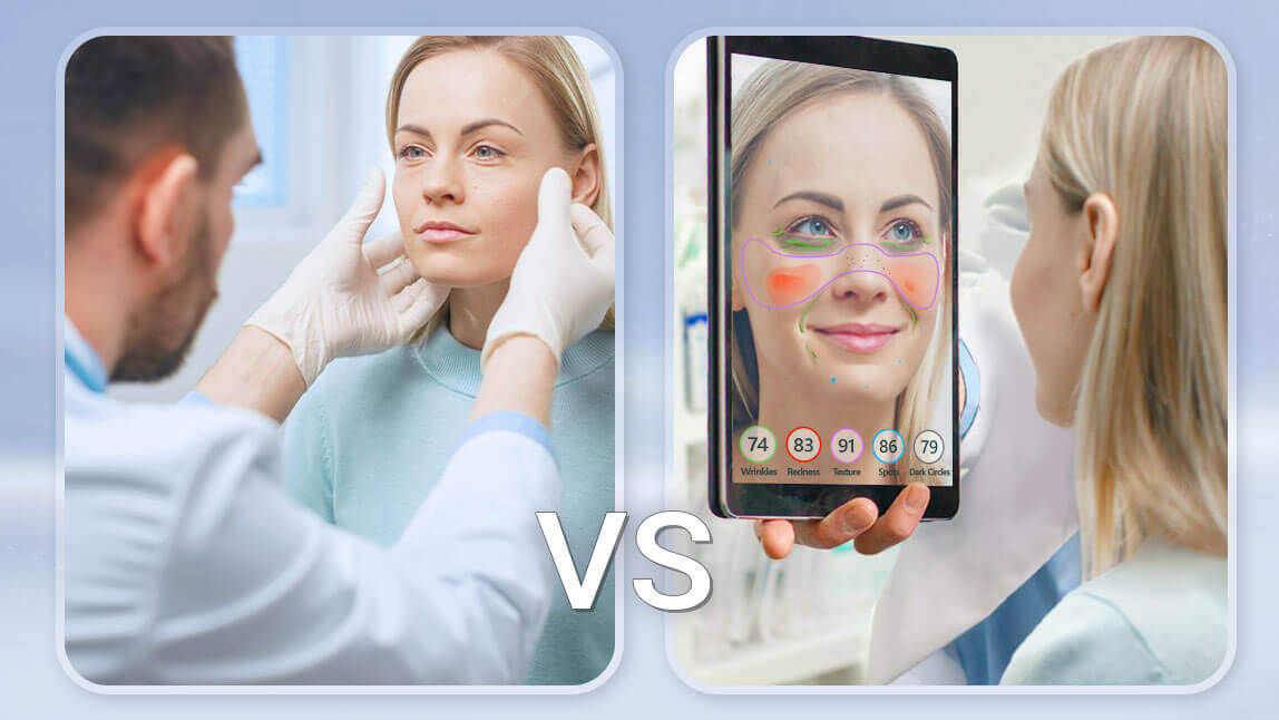 skin analysis