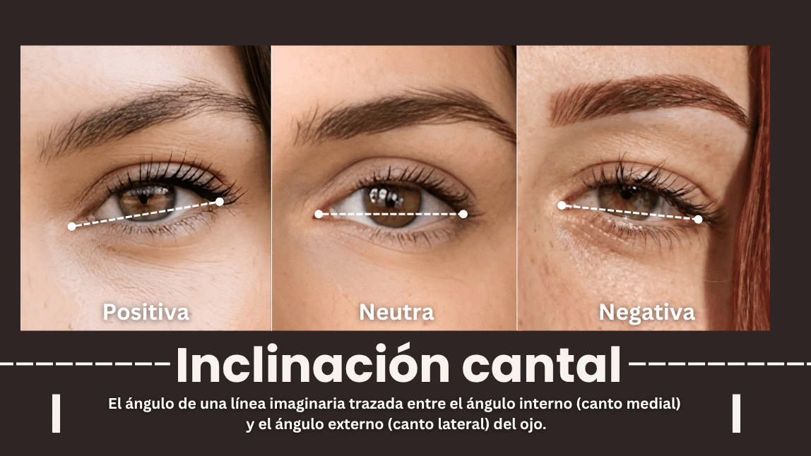 Tipos de inclinación cantal positiva, neutra y negativa Tipos de inclinación cantal positiva, neutra y negativa