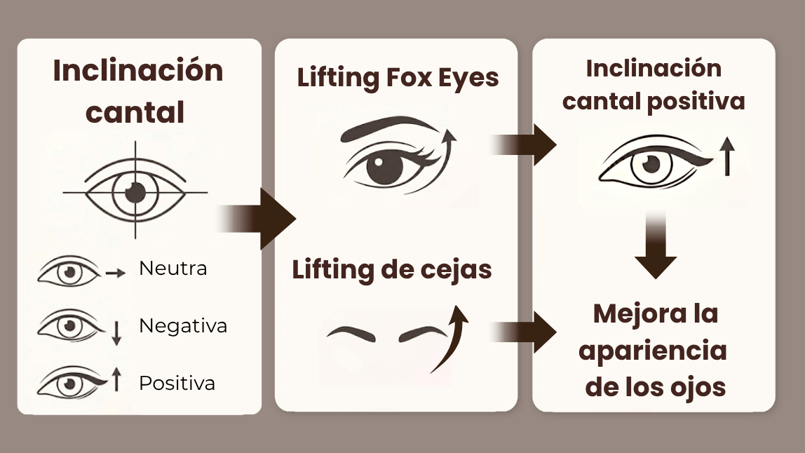Infografía de inclinación cantal positiva, neutra y negativa en los ojos Infografía de inclinación cantal positiva, neutra y negativa en los ojos