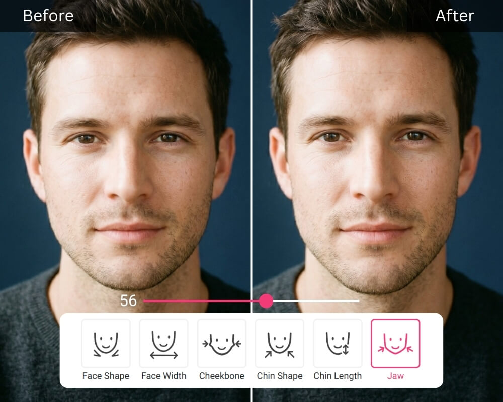 face reshape tool changing client's Gonial Angle