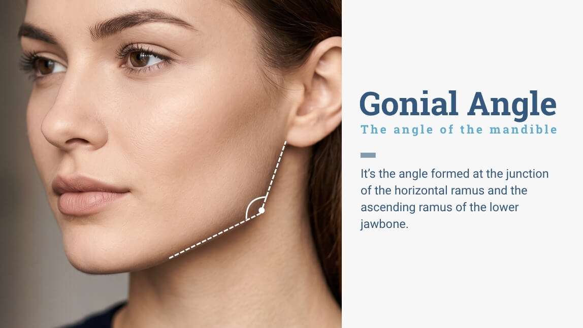 the meaning of the Gonial Angle