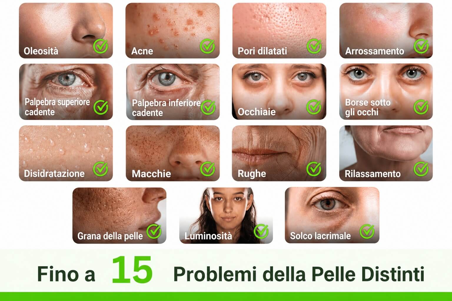 Skin Analyzer: Come l'AI Esegue l'Analisi della Pelle Skin Analyzer: Come l'AI Esegue l'Analisi della Pelle