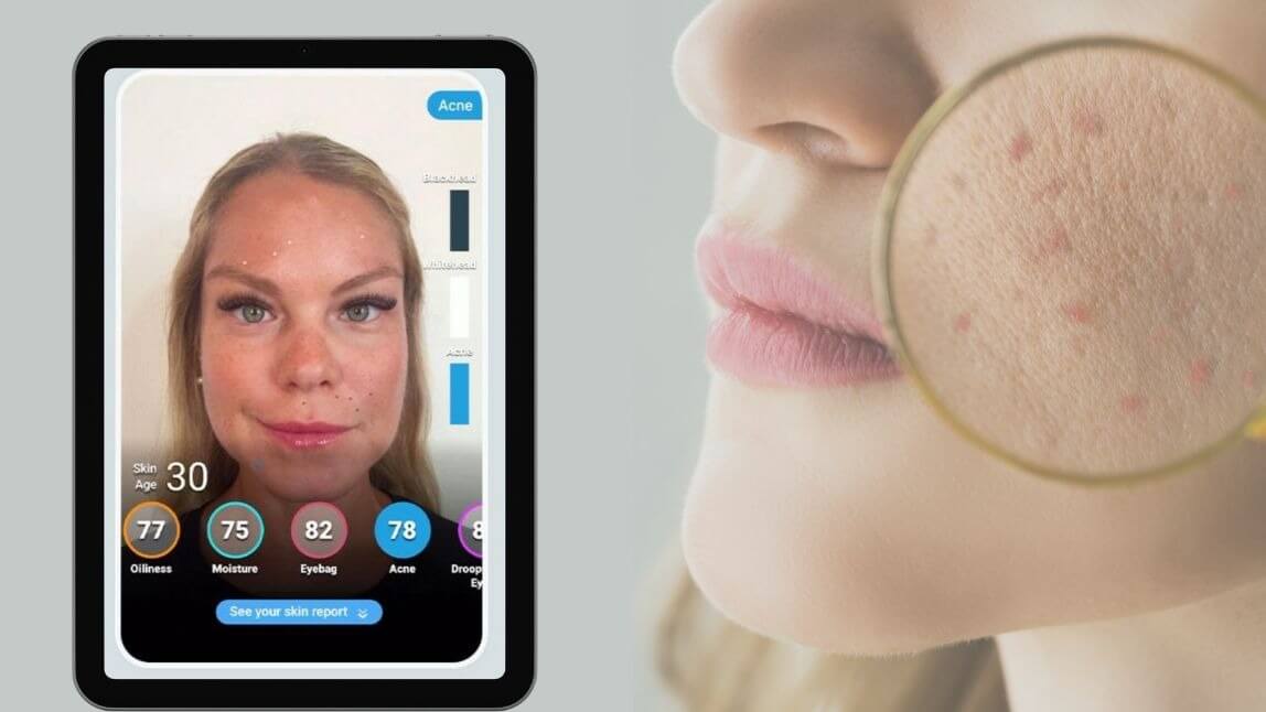 ai dermatologist skin scanner app