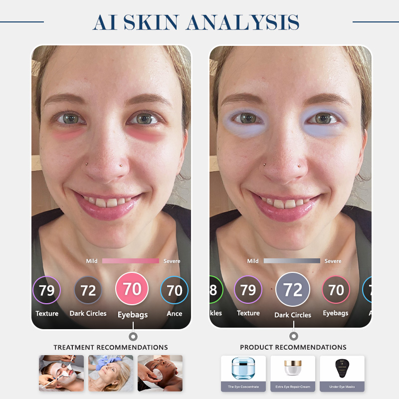 dark circles skin analysis