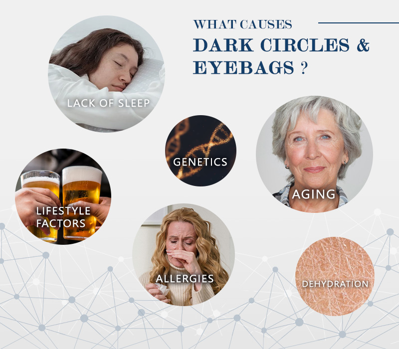 dark circles skin analysis