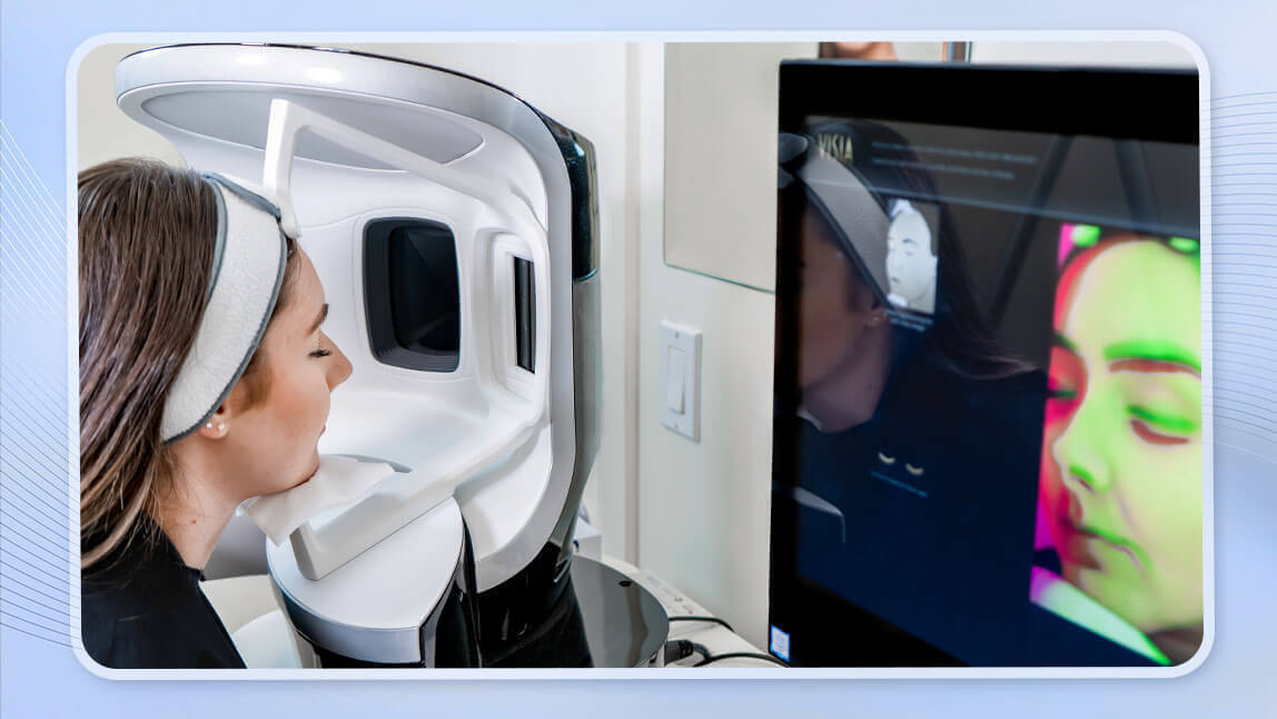 Máquina VISIA para análisis de piel