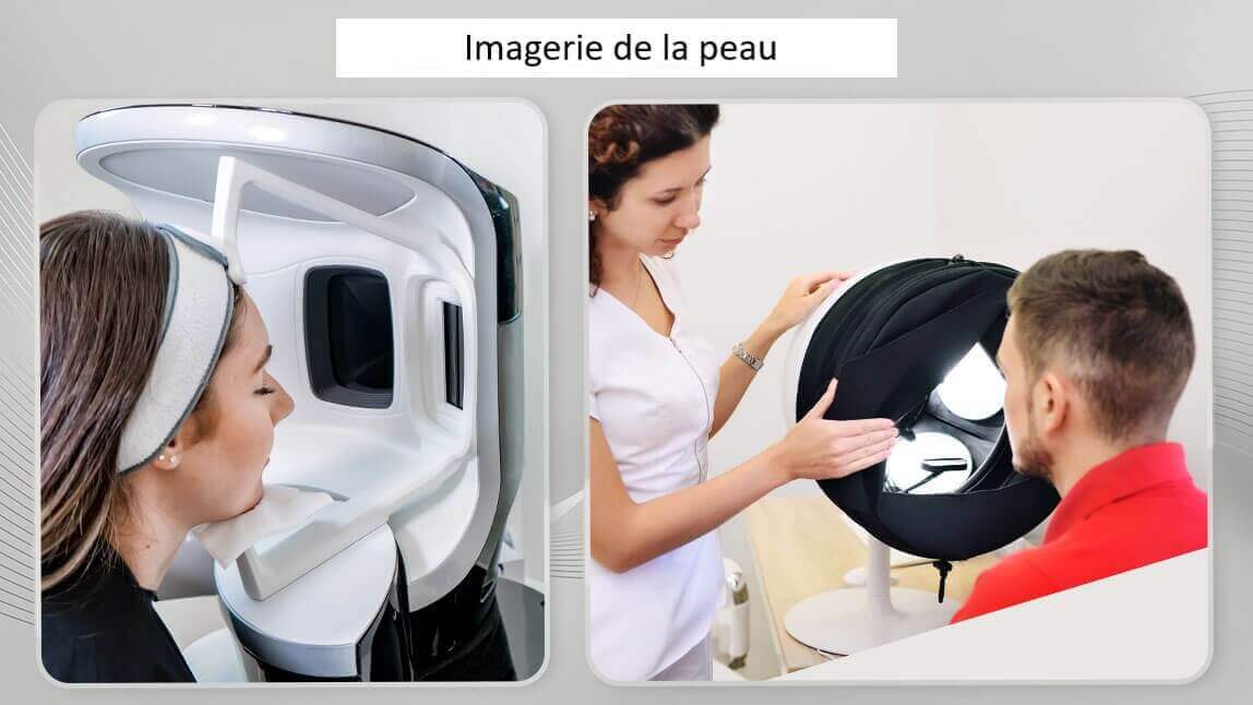 Imagerie de la peau