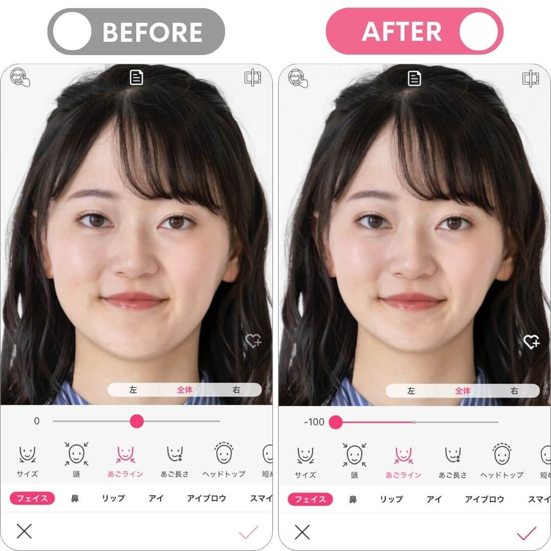 輪郭まわりの整形シミュレーション