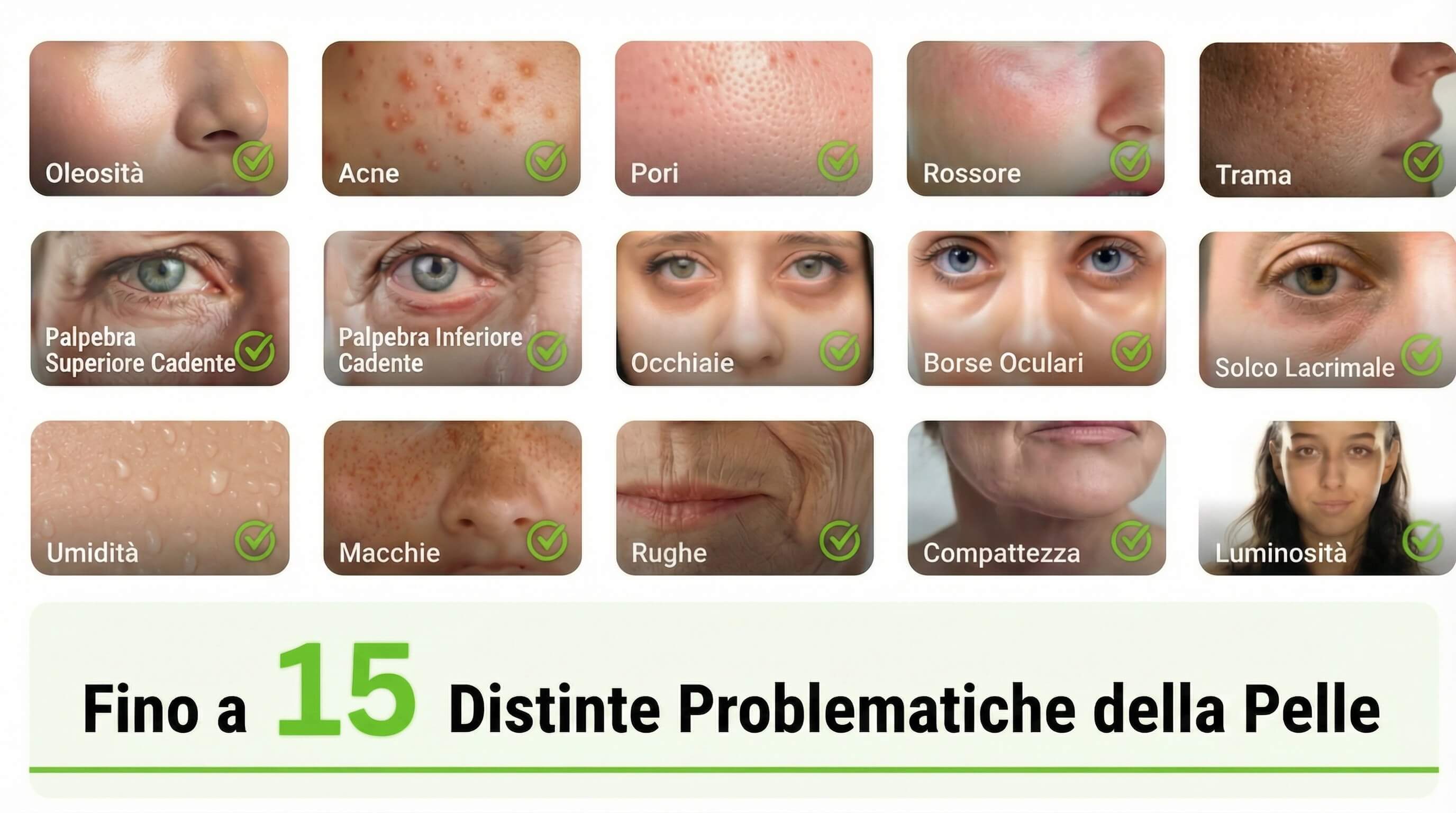 Lo skin analyzer AI rileva 15 inestetismi cutanei