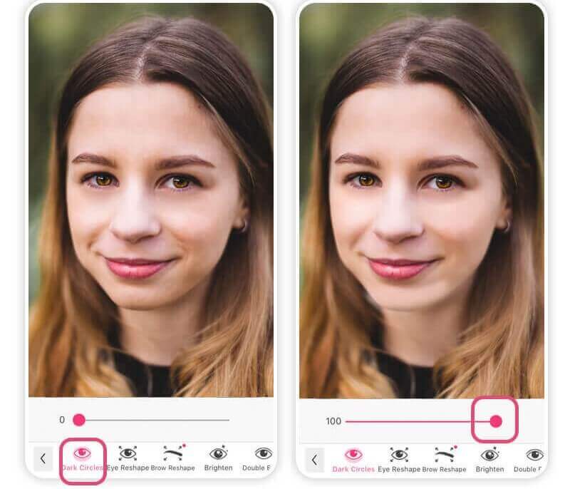 antes y después de eliminar las ojeras antes y después de eliminar las ojeras