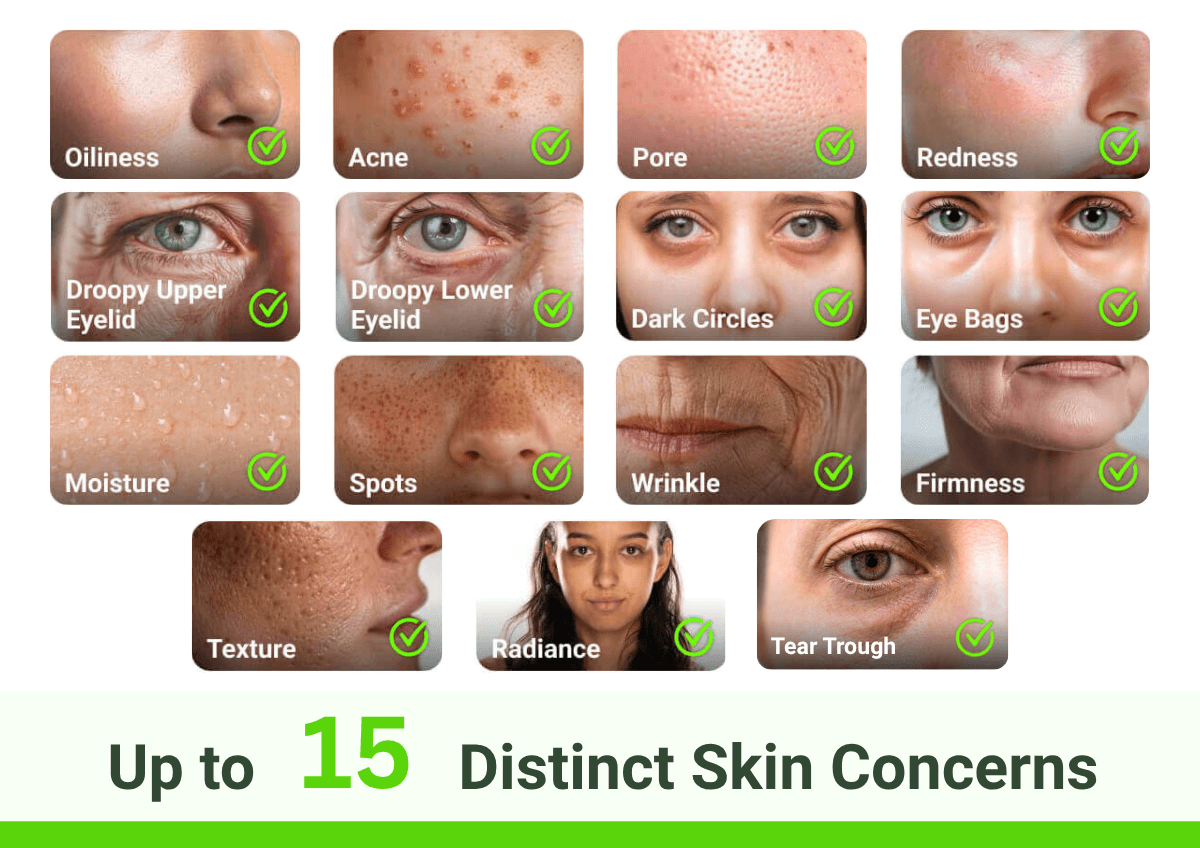Example skin analysis report showing scores for multiple skin concerns